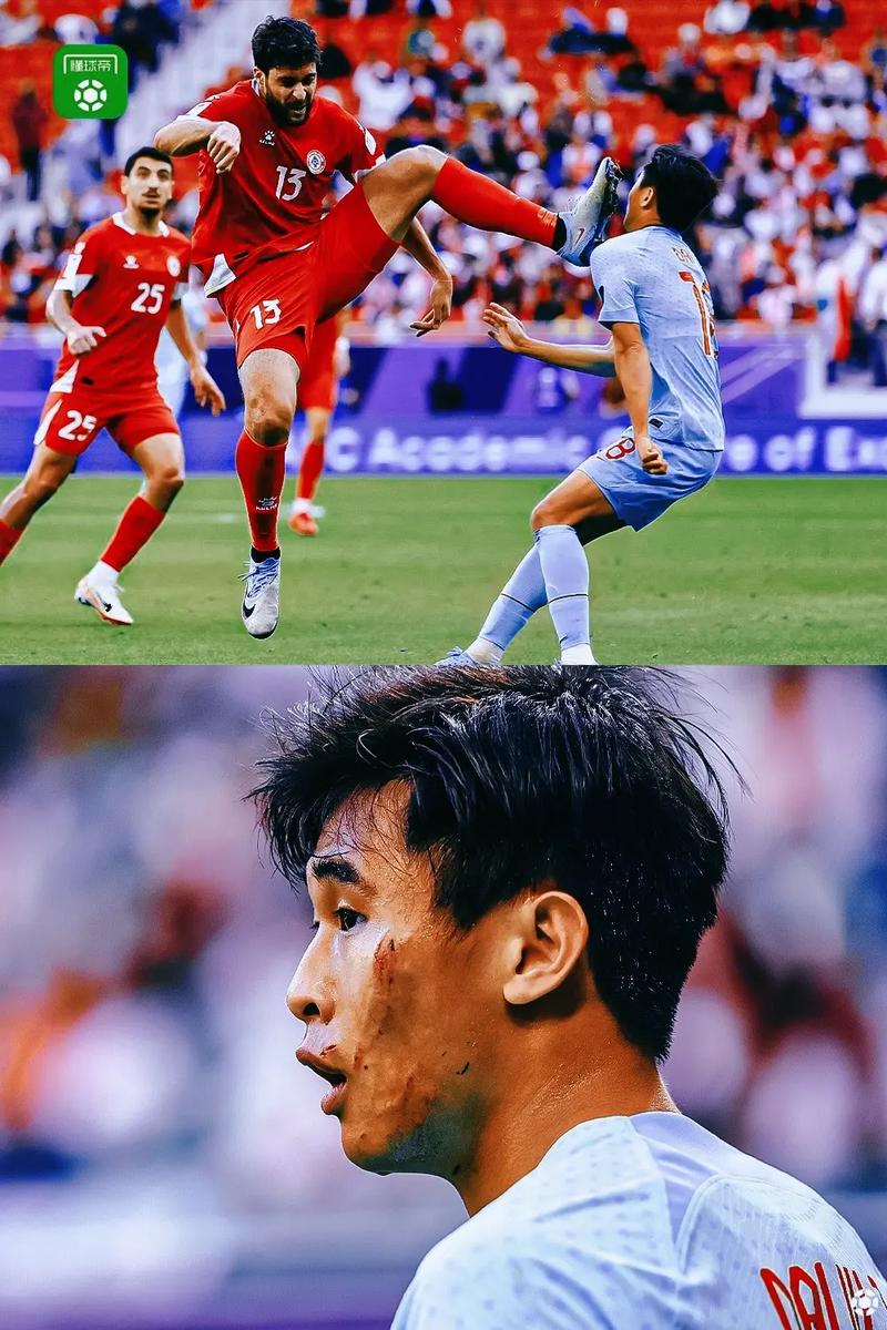 Cắt Bao Quy đầu